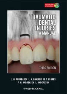 Traumatic Dental Injuries A Manual by Lars Andersson, Maria Teresa 
