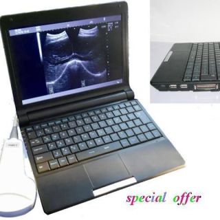 Laptop Ultrasound Scanner with 3.5Mhz Convex Probe Contec B Ultrosound