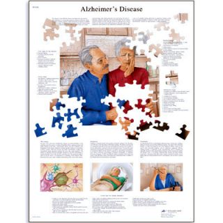 Alzheimers Disease Anatomical Anatomy Paper Chart 3B Scientific Poster 