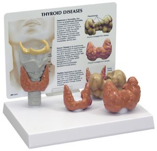 Thyroid Gland Anatomical Model 4 Piece Set with Pathologies LFA 3150 