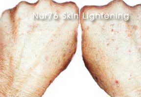 NUR76 Skin Lightening Cream Whitening Whitener Nur 76
